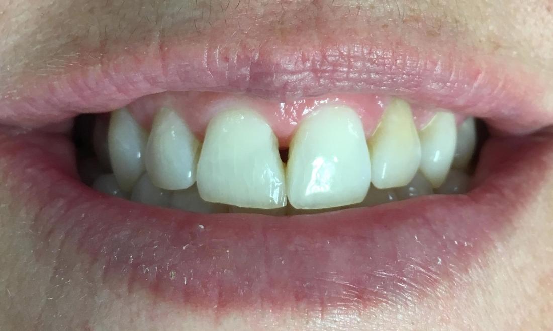 Cosmetic Dentistry | Workman Family Dental