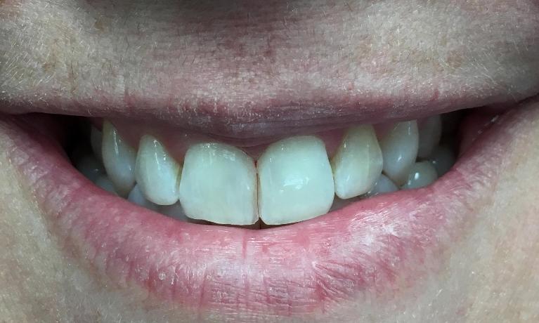 Cosmetic Dentistry | Workman Family Dental