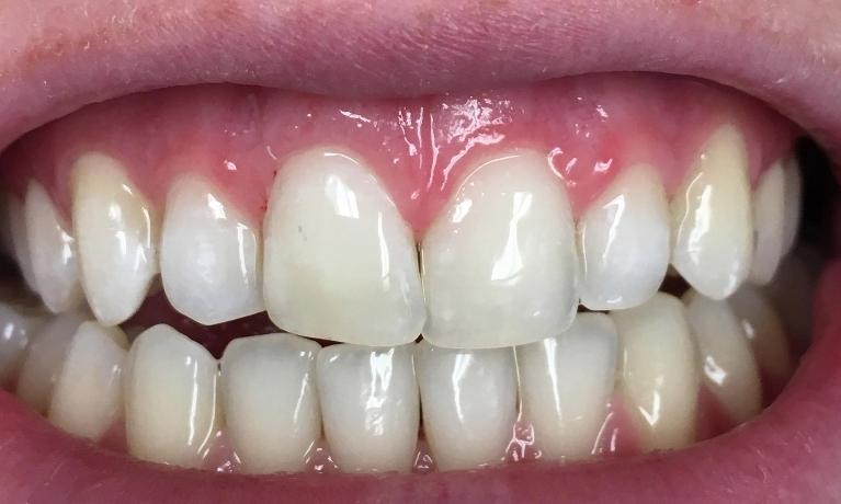 Cosmetic Dentistry | Workman Family Dental