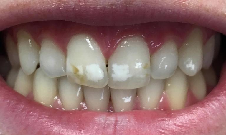 Cosmetic Dentistry | Workman Family Dental